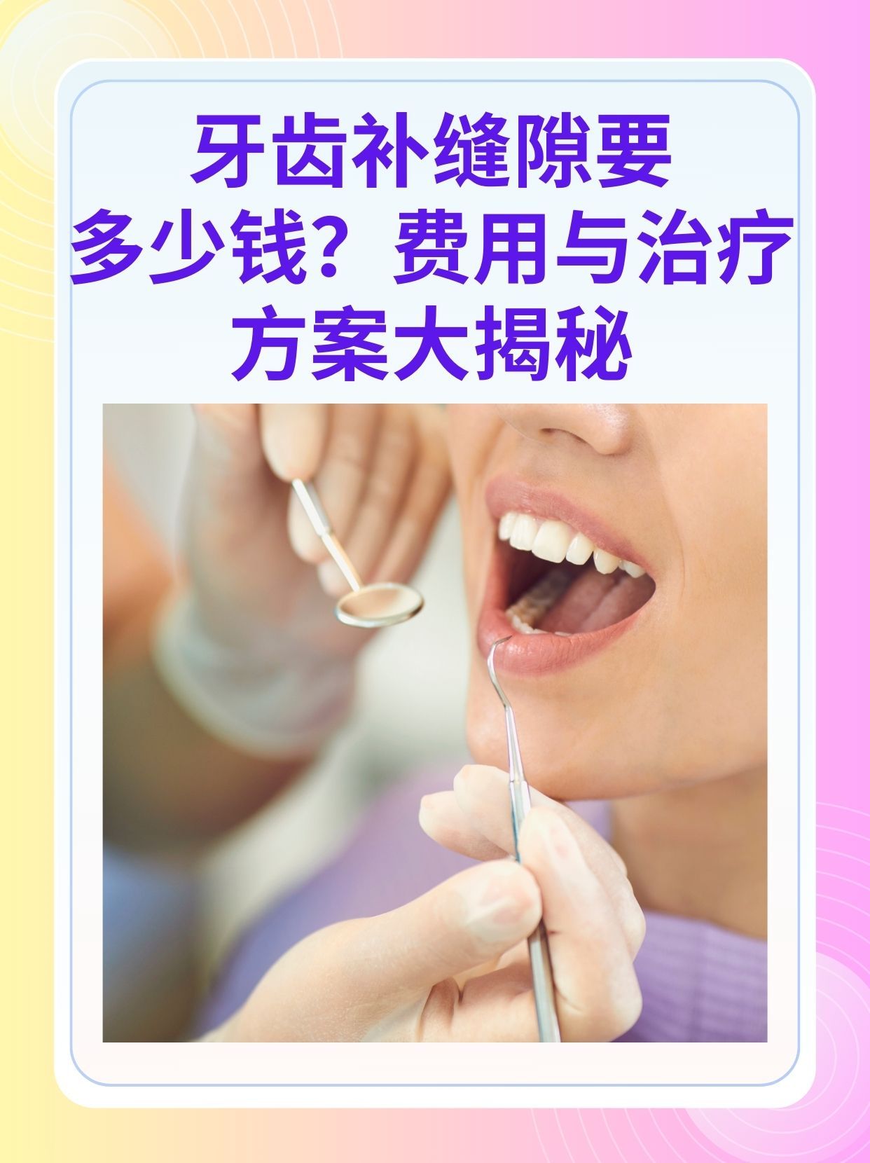 黄冈补牙医保可以报销吗(补牙医保可以报销吗 哪些可以报销呢)