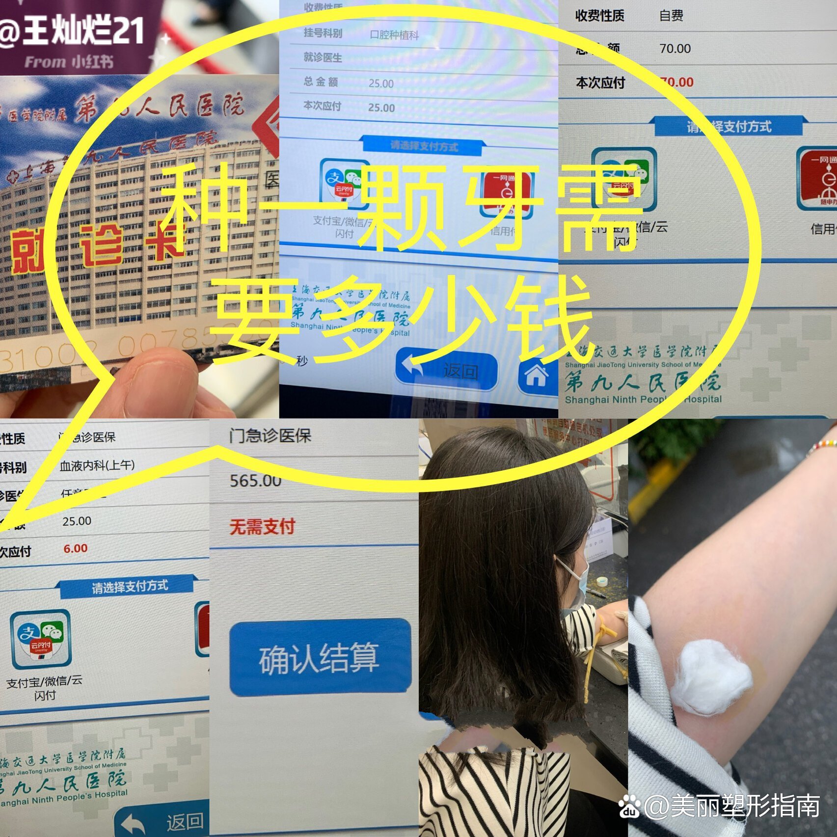 看牙可以用医保卡吗(看牙可以用医保卡里的钱缴费吗)